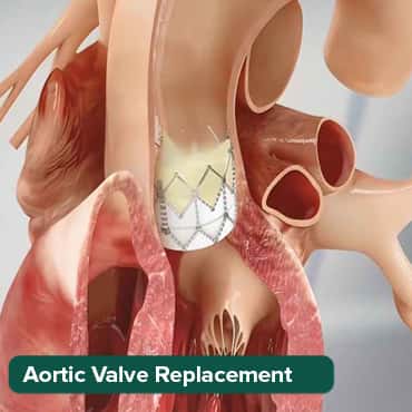 AVR - খোলা হৃদয়