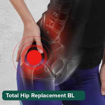 Total Hip Replacement-B/L