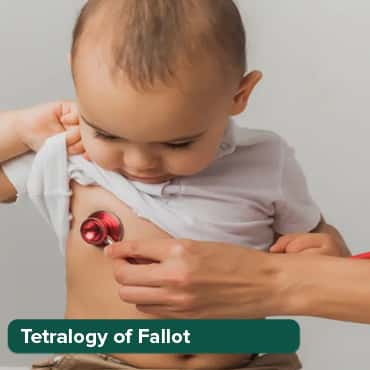 Tetralogy of Fallot (TOF)