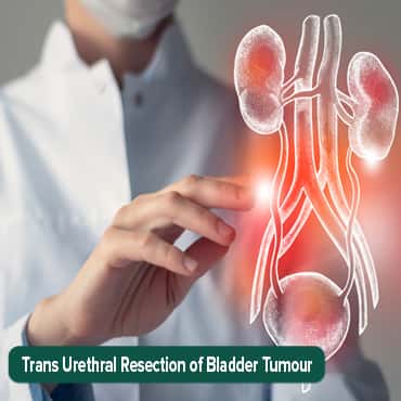 Reseksi transurethral tumor pundi kencing (TURBT))
