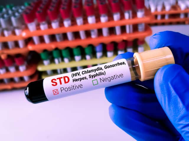 የላቀ STD ፓነል