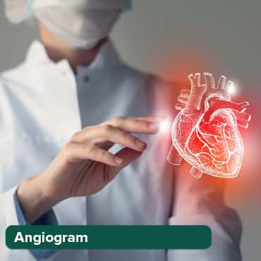 Angiografi