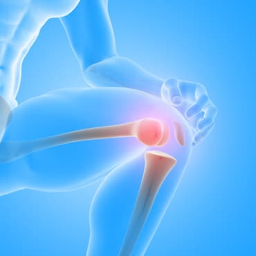 Penggantian Lutut Total-U/L