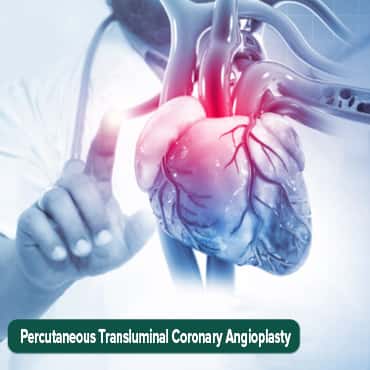 Percutaneous transluminal coronary angioplasty (PTCA)