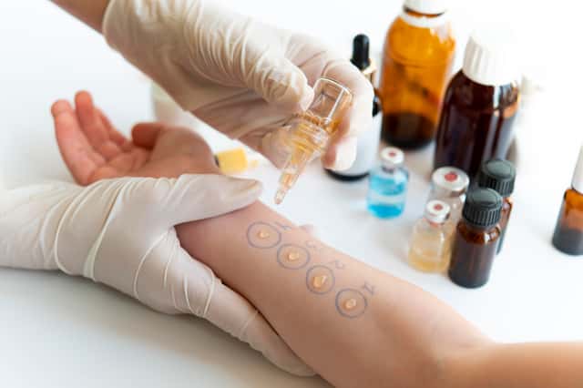 Combo-pack pour le test de piqûre de peau allergique et le test de la peau pour les allergies alimentaires